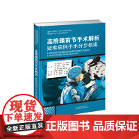 高阶眼前节手术解析:疑难病例手术分步指南 王勇、唐琼燕、华夏 本书聚焦复杂眼前节手术,重点强调人体工程学、手定位和仪器手