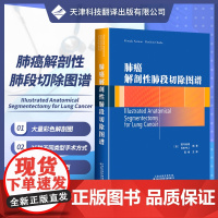 肺癌解剖性肺段切除图谱 肺段系统命名 肺段切除术技巧 右上肺 右下肺肺段切除术 左上肺 左下肺肺段切除术 袖式段切除术