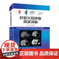 肝脏IX段肿瘤微波消融 王在国 周建平 主编 肝脏肿瘤微波技术导管消融应用 肝脏肿瘤癌症术后并发症围术期护理 北京大学医