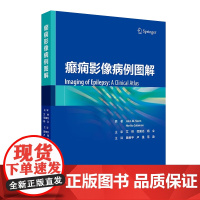 癫痫影像病例图解 田树平 卢强 范淼 主译 海马硬化头部发育畸形感染外伤等癫痫案例 癫痫的PET影像MR诊断疗效评估 人