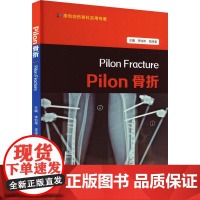 PILON骨折