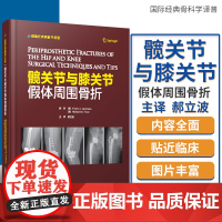 髋关节与膝关节假体周围骨折 骨科医学临床医学西医 医学读物 临床医学 弗兰克 A 利珀斯著 9787504683250