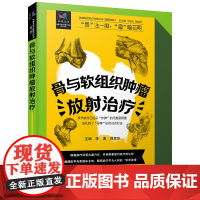 骨与软组织肿瘤放射治疗 肿瘤放射治疗科普丛书