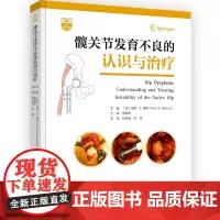 髋关节发育不良的认识与治疗