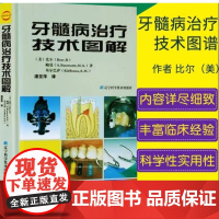 牙髓病治疗技术图解(微瑕处理不退不换)