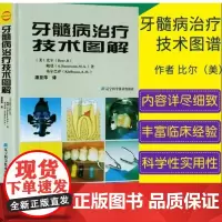 牙髓病治疗技术图解(微瑕处理不退不换)