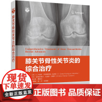 膝关节骨性关节炎的综合治疗