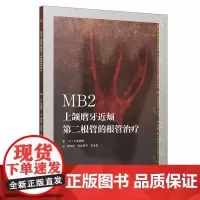 [牙体牙髓]MB2上颌磨牙近颊第二根管的根管治疗
