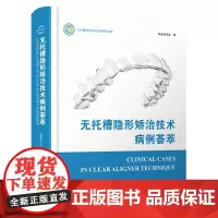 无托槽隐形矫治技术病例荟萃