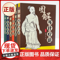 正版 图解耳针、刺血、针刀、一针、艾灸、拔罐疗法[全6册]9787504694720