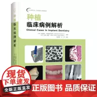 [处理,不退不换]口腔书 种植临床病例解析(书角轻微磕碰)