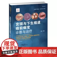 []宫颈与下生殖道癌前病变诊断与治疗 宫颈癌前病变诊治方法 非感染因素引起的女性宫颈等病症 阴道镜检查