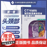 []CT与MRI袖珍解剖断层图谱第一卷头颈部 医学影像诊断学 头影测量ct读片ct诊断临床 脑部血管造影术天津科技翻译出