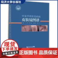 甲及甲周常见疾病皮肤镜图谱 同济大学出版社 指趾甲的健康问题 临床皮肤镜检查甲病的相关相应的指导