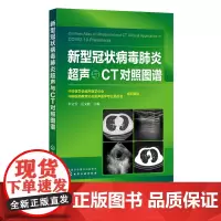 新型冠状病毒超声与CT对照图谱 图谱由中华医学会超声医学分会和中国医药教育协会超声医学专业委员会组织全国相关影像专家