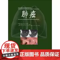AME科研时间系列医学图书003:肺癌(丁香园出品)