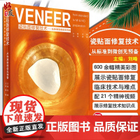 VENEER 瓷贴面修复技术 从标准到微创无预备 刘峰 口腔美学修复学实用教程口腔美学修复学书籍口腔美学书籍口腔医学牙体