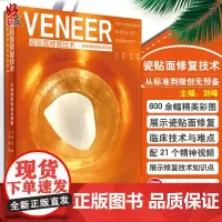 VENEER 瓷贴面修复技术 从标准到微创无预备 刘峰 口腔美学修复学实用教程口腔美学修复学书籍口腔美学书籍口腔医学牙体