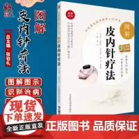 正版 图解皮内针疗法 中医适宜技术操作入门丛书 周丹主编 中国医药科技出版社 中医基础理论中医临床中医入门参考书9787