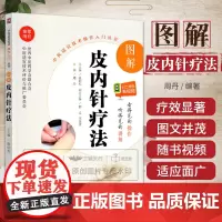 无视频-图解皮内针疗法 中医适宜技术操作入门丛书 针灸治疗学 针