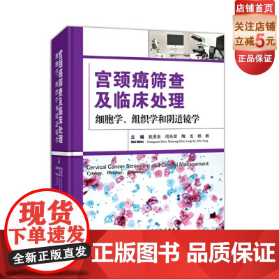 宫颈癌筛查及临床处理:细胞学、组织学和阴道镜学