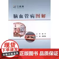 脑血管病图解 徐蔚海 主编 内科学生活 正版图书籍 人民卫生出版社
