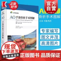 AO手部骨折手术图解 耶西.朱庇特 手部骨折处理指导性教材 骨科/手外科医师及相关临床工作者适用 上海科学技术出版社