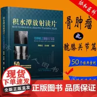 积水潭放射读片——骨肿瘤与髋膝关节篇