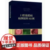 [出版社]口腔黏膜病病例精粹80例/9787565919824/188/72/ 华红 高岩 北京大学医学出版社