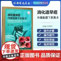 消化道早癌内镜黏膜下剥离术 内科学 肿瘤学 内镜黏膜下剥离术 肿瘤书籍 医学类书籍 王贵齐 主编 97871172906