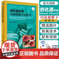 消化道早癌内镜黏膜下剥离术 内科学 肿瘤学 内镜黏膜下剥离术 肿瘤书籍 医学类书籍 贵齐 主编 978711729067