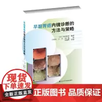 [正版书籍]早期胃癌内镜诊断的方法与策略