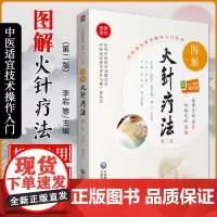 无视频-图解火针疗法中医适宜技术民间传统jue学火针疗法操作入门