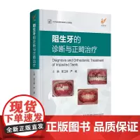 阻生牙的诊断与正畸治疗 口腔正畸学 口腔修复学 口腔书籍 正畸书籍
