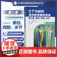 [ 出版社]CT与MRI袖珍断层解剖图谱 第3卷:脊柱、四肢、关节 放射解剖和精准的CT与MRI断层解剖图像 医学影