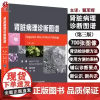 肾脏病理诊断图谱(第3版)用于诊断肾脏疾病的实用参考书 原发性肾小球疾病 甄军晖 主译 北京大学医学出版社 978756