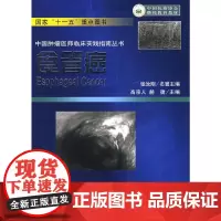 [正版书籍]食管癌