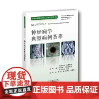 [正版书籍]神经病学典型病例荟萃