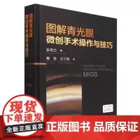 图解青光眼微创手术操作与技巧