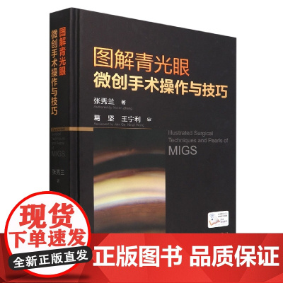 图解青光眼微创手术操作与技巧