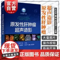 原发性肝肿瘤超声造影 东方超声文库上海科学技术出版社复旦大学附属中山医院超声科多年经验经典病例凝集肿瘤学