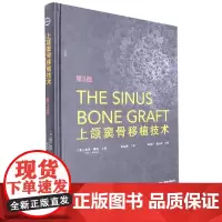上颌窦骨移植技术:第3版