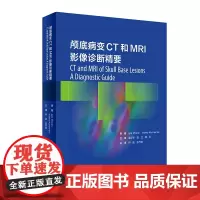 颅底病变CT和MRI影像诊断精要翻译版颅底病变诊断系统性知识综合分析诊断颅底病变常规影像新技术CT灌注MRI