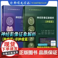 神经影像征象解析肿瘤篇+非肿瘤篇医学影像联盟经典丛书两本套装肿瘤性与非肿瘤性病变的影像学诊断书籍科学技术文献出版社