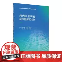颅内血管疾病超声图解100例 2024年4月参考书