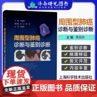 周围型肺癌诊断与鉴别诊断 上海科学技术出版社 主编 李成州 适合影像科 呼吸内科 胸外科 肿瘤科医生等阅读参考 孤立性肺