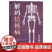 骨结核病 解码结核病 浙江省疾病预防控制中心浙江省中西医结合医院浙江省防痨协会编著 结核病预防性治疗指南公共卫生疾病预防