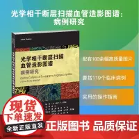 光学相干断层扫描血管造影图谱:病例研究 邵毅 谭钢 余瑶 一本内容丰富、实用的OCTA指导手册。 眼底疾病诊断与治疗中