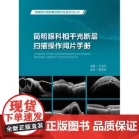 简明眼科相干光断层扫描操作阅片手册