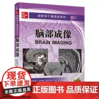 放射学个案综述系列.脑部成像